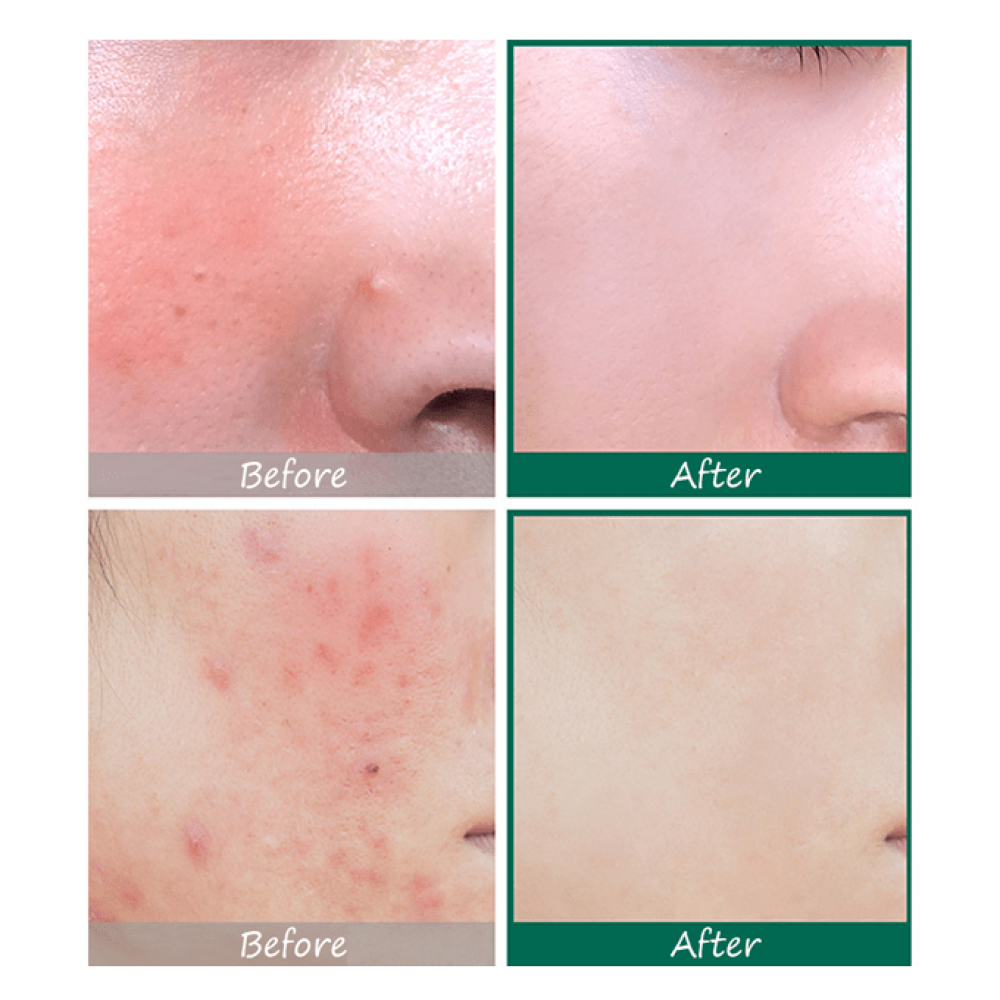 سيروم المعجزة AHA BHA PHA من سوم باي مي 50مل – Some By Mi AHA BHA PHA 30 Days Miracle Serum 50ml