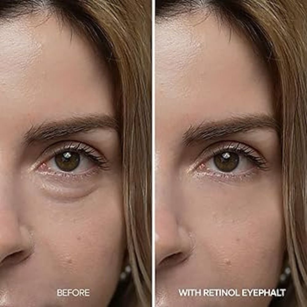 Dr.Melaxin Eyephalt Retinol Eyebag Cream 10g