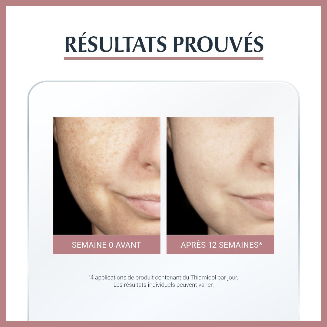 Eucerin Anti Pigment Sérum Duo سيروم مكافحة البقع الداكنة من أوسيرين