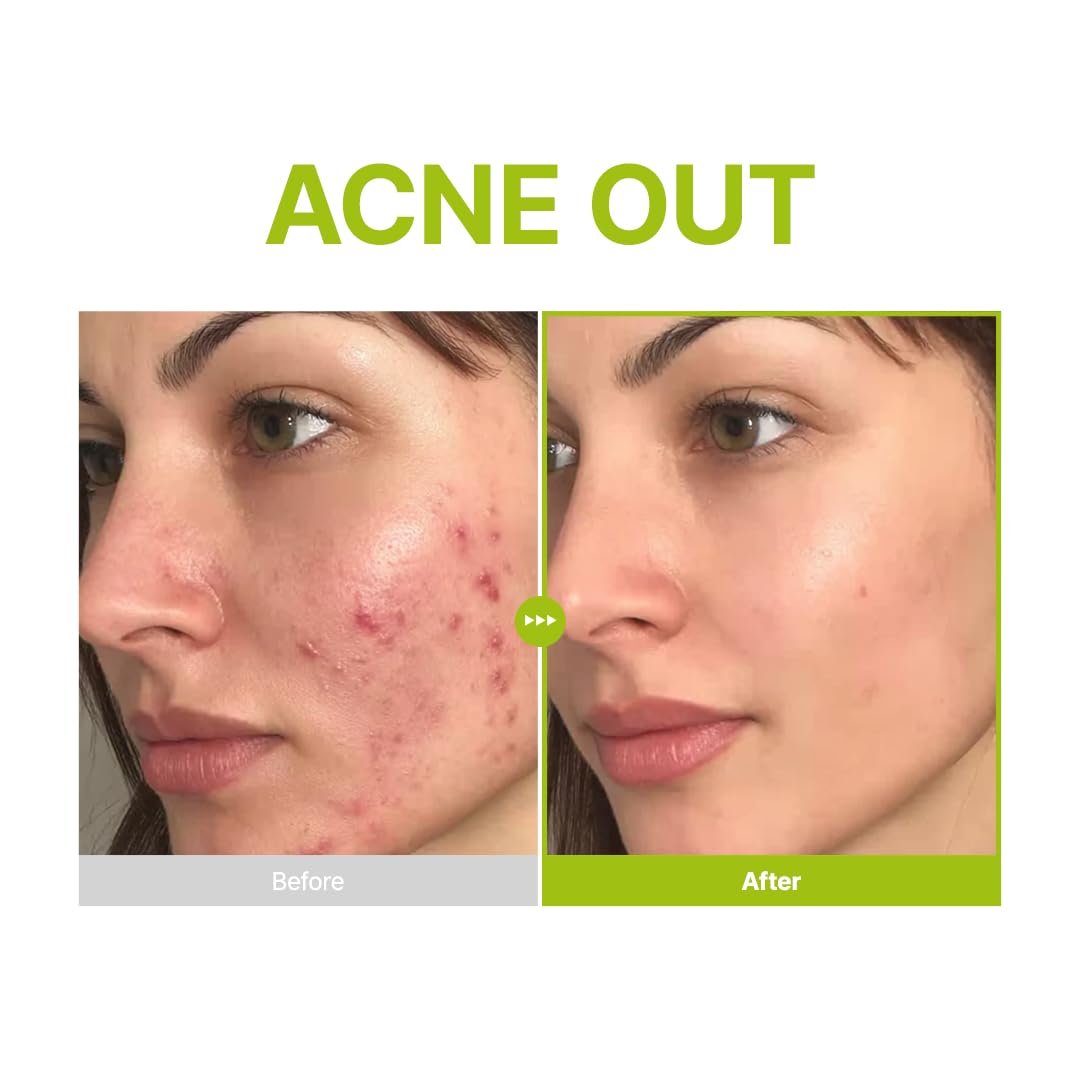 PURITO Azelaic Acid 10% + Kojic Acid + Tea Tree 30ml