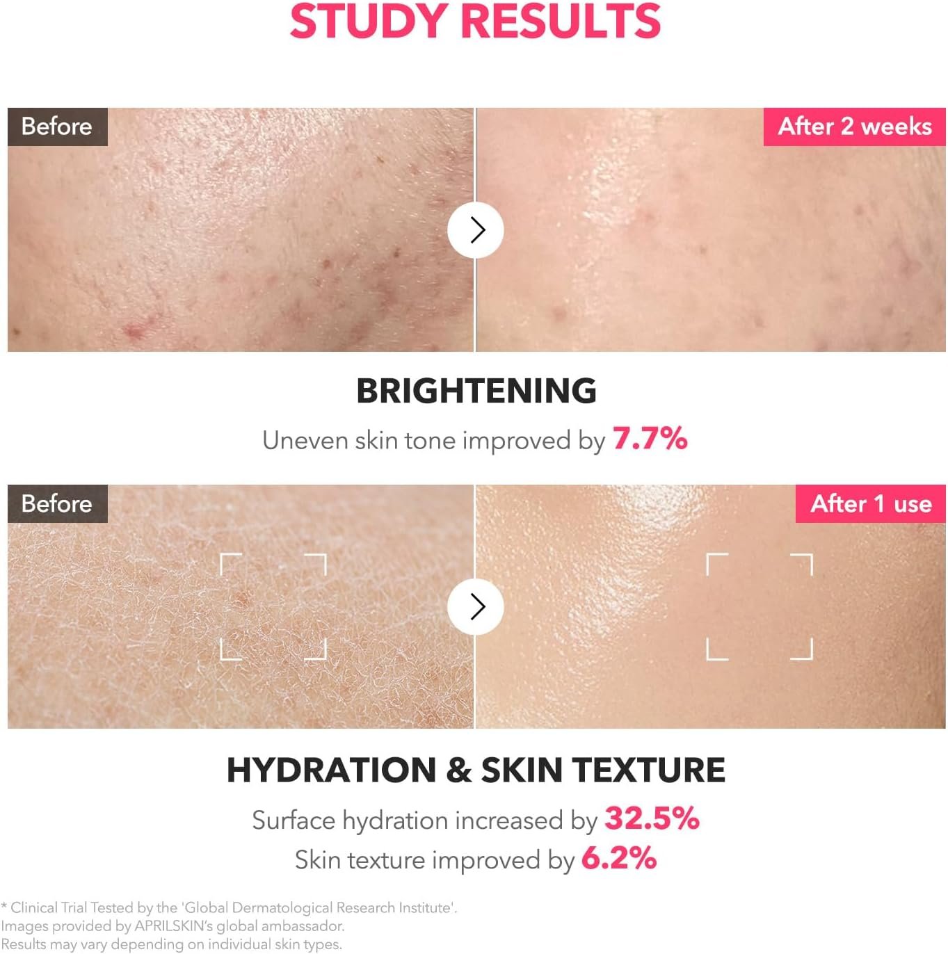 APRILSKIN TXA+Niacinamide 99 Pink Milky Toner | 99% High-Purity TXA 3%+ Niacinamide 5% for Brightening | Highly Concentrated Cream Toner | Deep Moisturizing Formula for Dull Skin | 5.07 fl.oz.