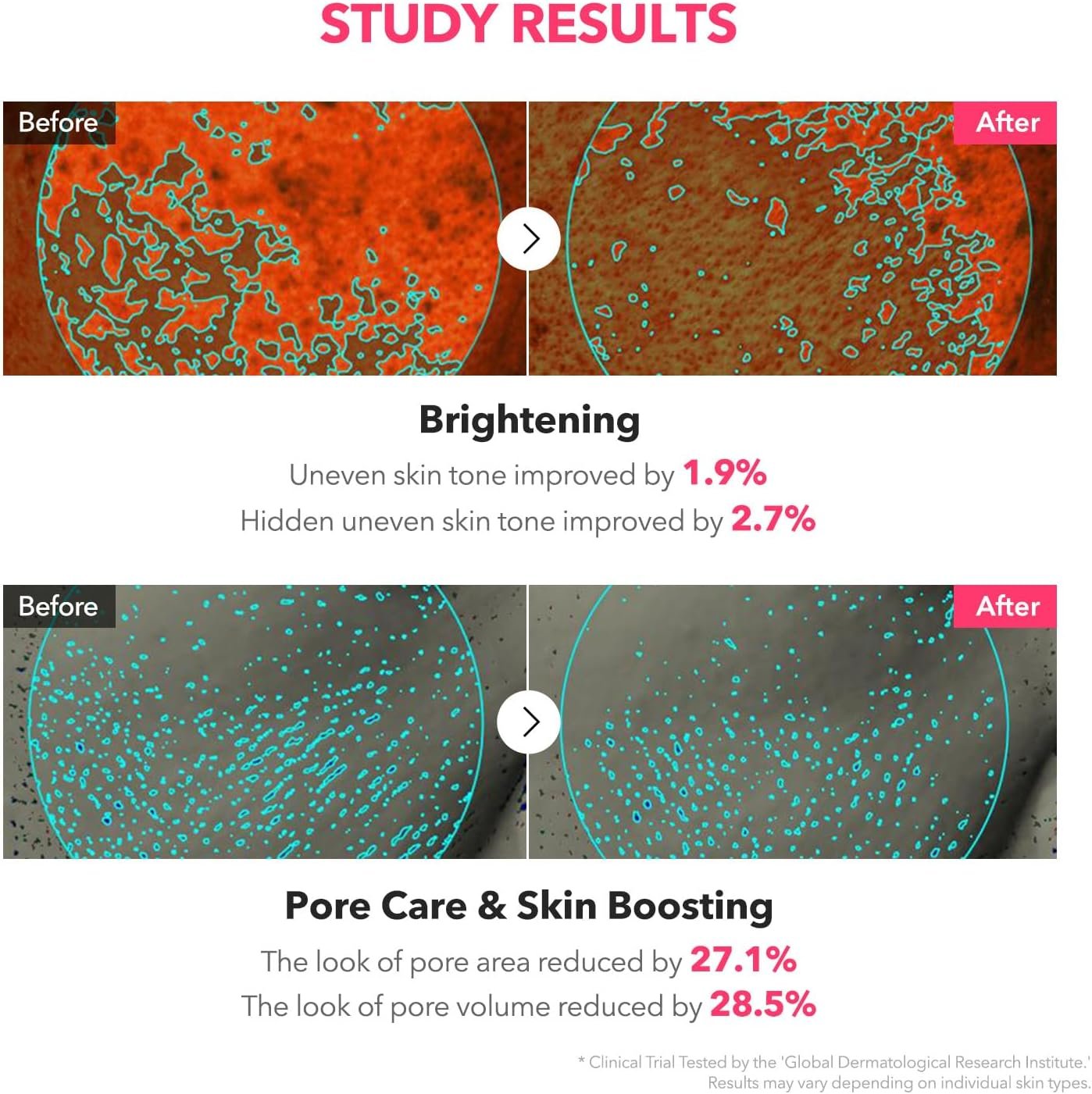 APRILSKIN TXA Niacinamide Toning Shot 99 Spicule Facial Serum｜Skin Booster Serum for Brightening and Pore Care｜99% High-Purity Tranexamic Acid 3% + Niacinamide 5%｜Korean Skin Care｜1.01 fl. oz.