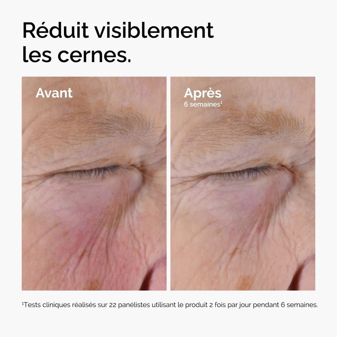 The Ordinary Solution à la Caféine 5% + EGCG, Sérum anti-cernes pour les contours des yeux noirs et fatigués, 30 ml