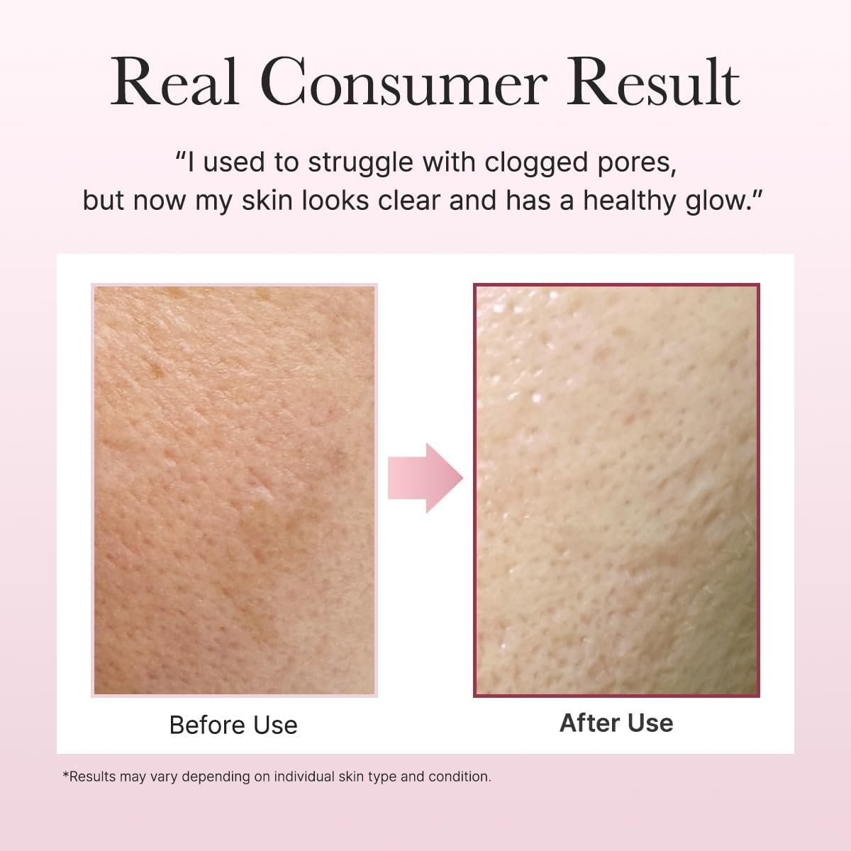 Arencia fresh Rosehip Rice Mochi Cleanser