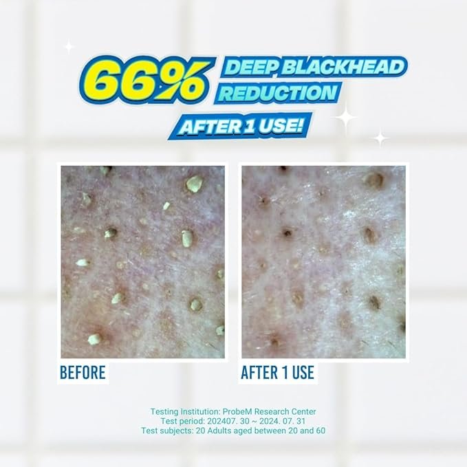 JUMISO Blackhead Melting Softener