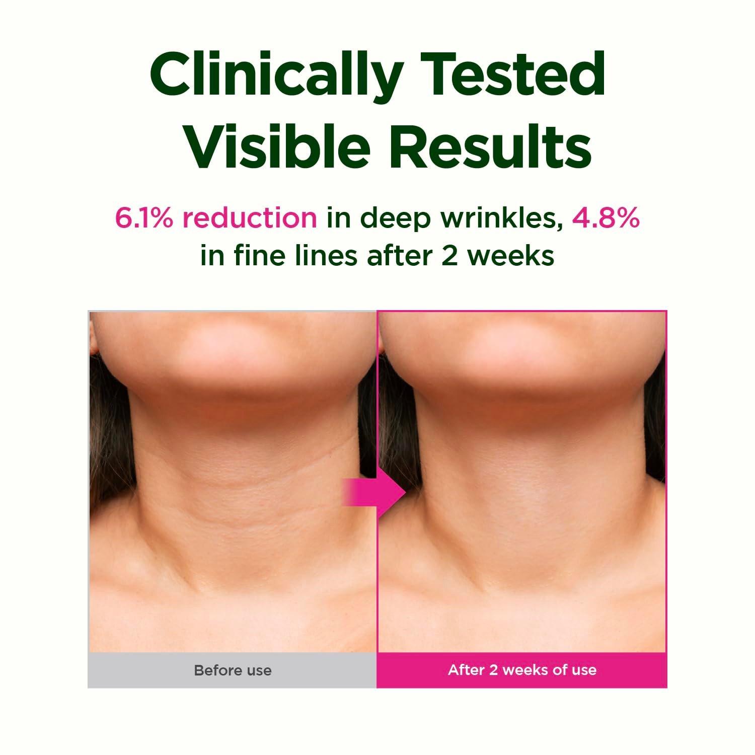 CKD Retino Collagen Gua Sha Neck Cream
