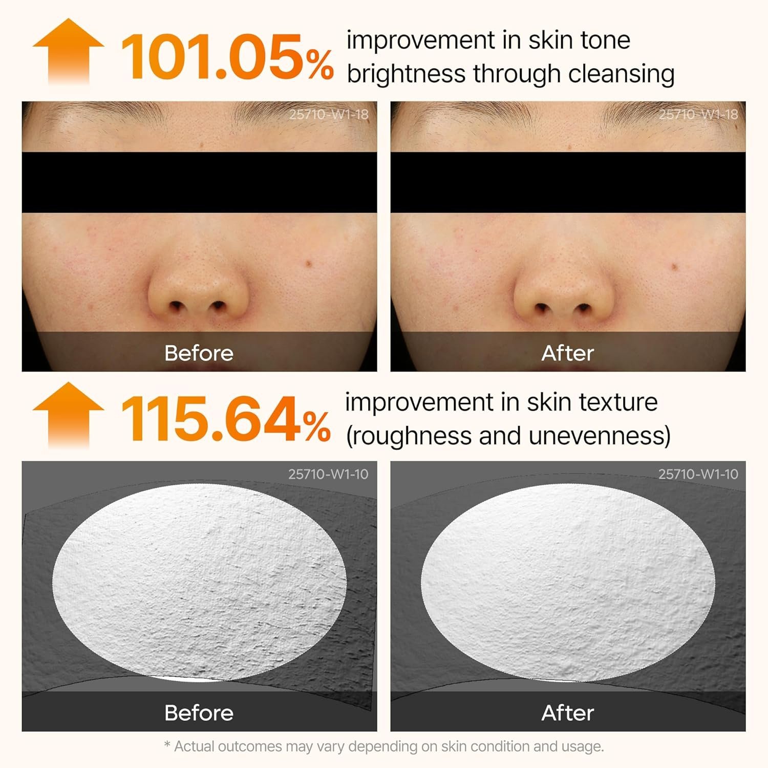 Dr.Melaxin Peel Shot Kojic Acid Turmeric Serum – Exfoliating Dark Spot Corrector with AHA/BHA & Niacinamide, Brightening & Even Tone Facial Serum (80ml / 2.70 fl oz)