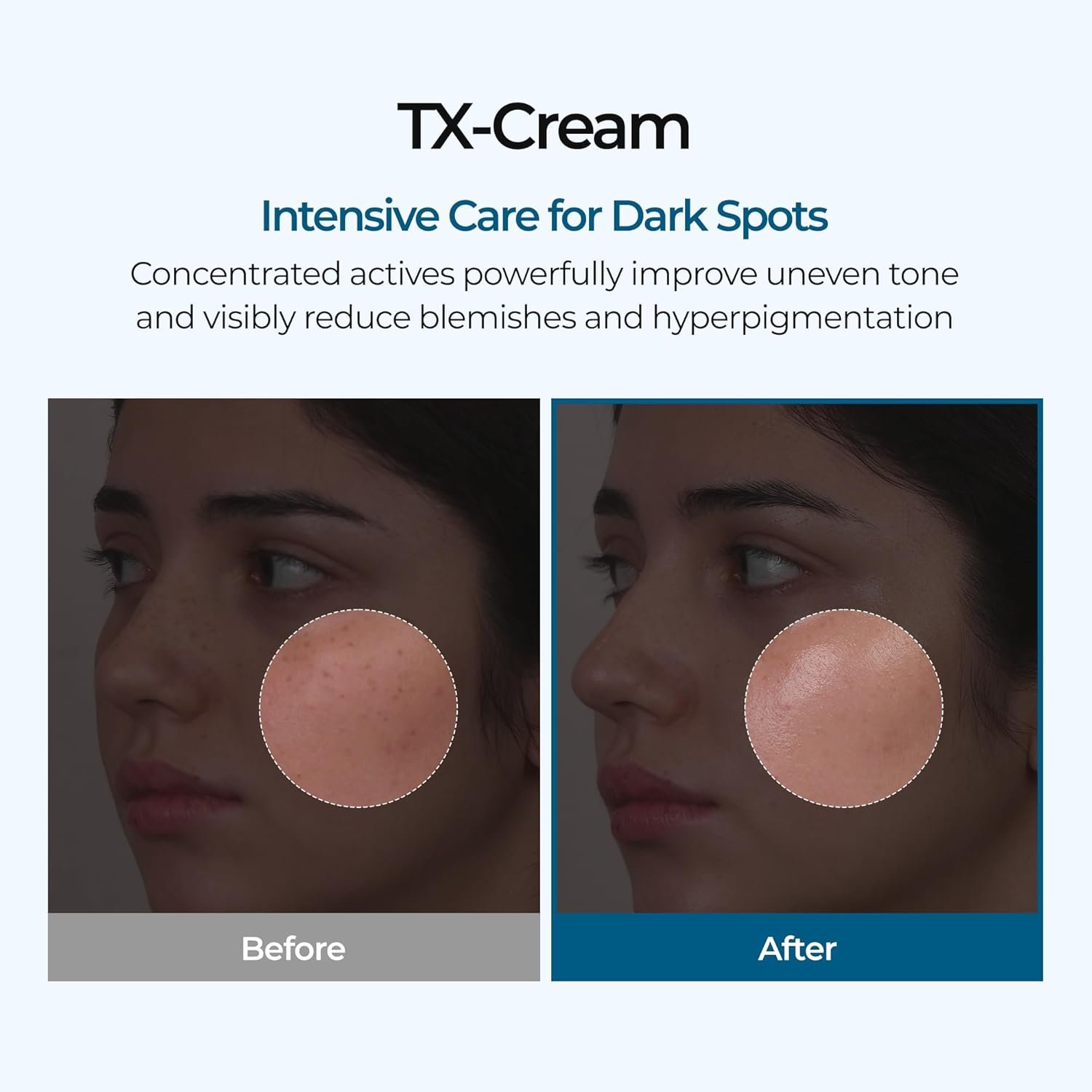 DR.Melaxin TX Tranexamic Acid CREAM 50g