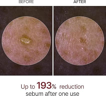 Dr.Melaxin Peel Shot  Ampoule exfoliante au riz noir 80ml