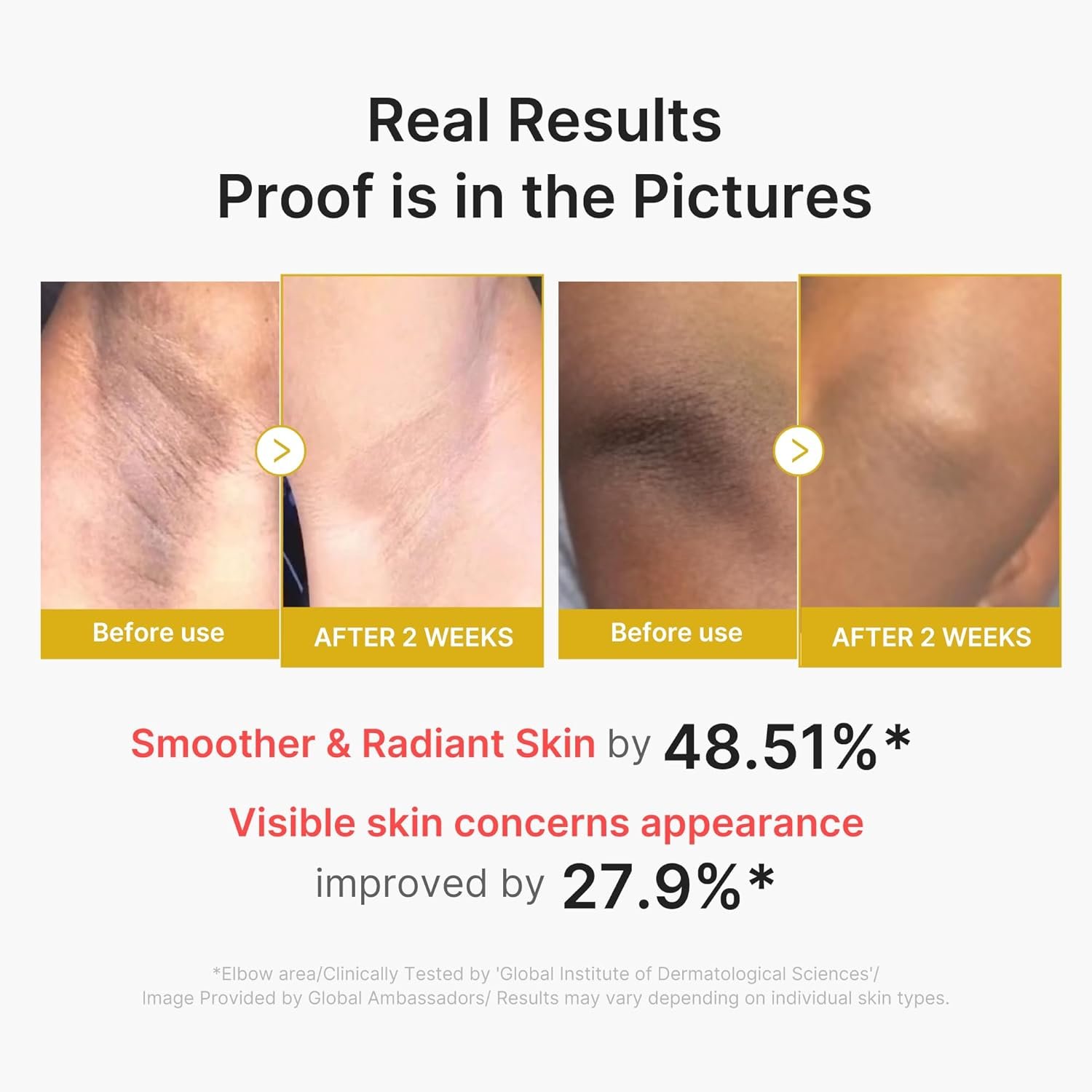 Medicube Body Peel Shot 280ML