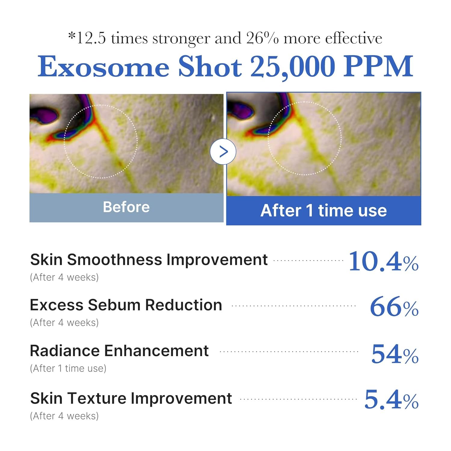 Medicube Exosome Shot Zero 25,000 PPM Spicule Facial Serum | Liquid Skin Booster Serum | Exosome, AHA+BHA+PHA | Pore Care, Dead Skin Cells, Skin Texture | Korean Skincare, 0.43 fl.oz