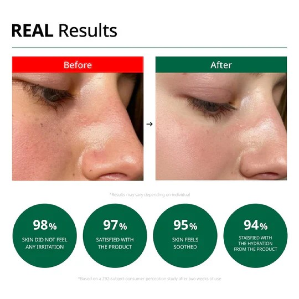 Dr.G – R.E.D Blemish Clear Soothing Cream 70ml كريم ملطف و مرطب من دكتور جي 70 مل