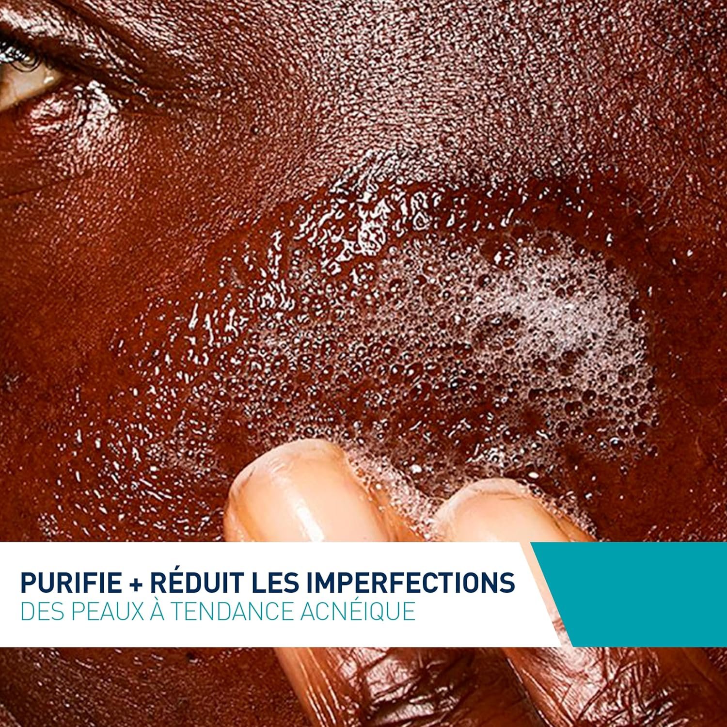 غسول الوجه لعلاج حب الشباب من سيرافي CeraVe Gel Moussant Anti-Imperfections – 236 ML – Nettoyant Visage Purifiant à l’Acide Salicylique – Réduit les boutons et les imperfections – Pour peaux à imperfections et à tendance acnéique