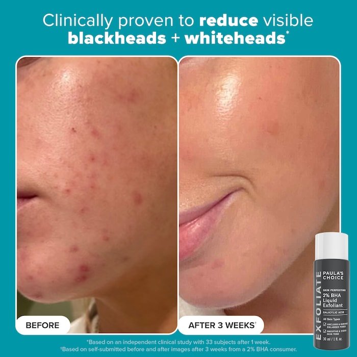 Paula’s Choice  Exfoliation Icons Kit