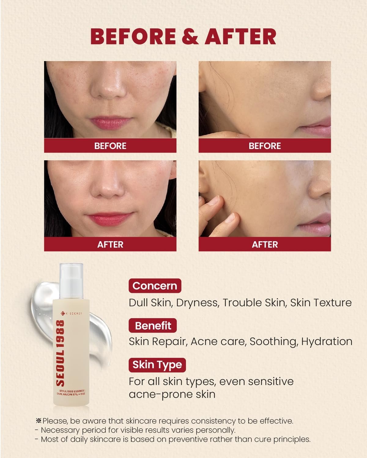 K-SECRET SEOUL 1988 Essence : Snail Mucin 97% + Rice موسين الحلزون 97% + أرز من كيه سيكريت