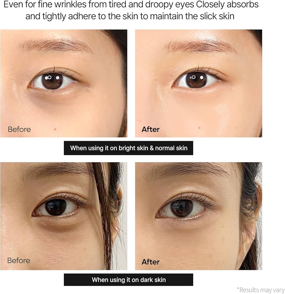 Dr.Melaxin Calcium Dark Spot Eye Cream 15g – Niacinamide & Calcium Gluconate Eye Cream for Dark Circles, Under Eye Bags & Sagging | Hydrolyzed Elastin EX Volume Firming | Korean Eye Cream