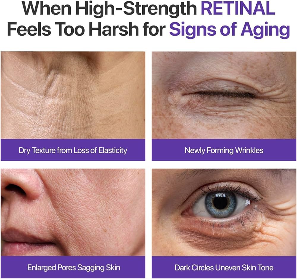 numbuzin No.9 NAD+ Retinal Volumetox Eye Cream, Anti-Aging Treatment for Wrinkles, Fine Lines, Dark Circles & Dark Spots, Gentle Retinal Formula with Peptides & Niacinamide, 0.67 fl. oz.