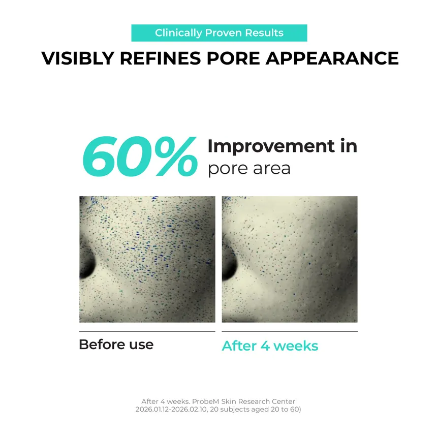 JUMISO Overnight Zero Pore Nose Patch  لاصقات ليلية