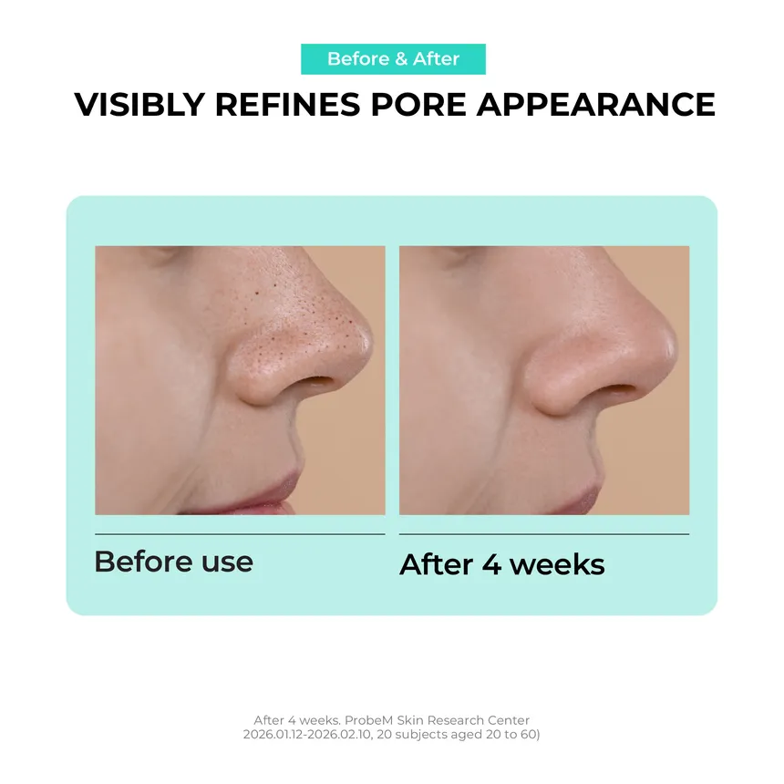JUMISO Overnight Zero Pore Nose Patch  لاصقات ليلية