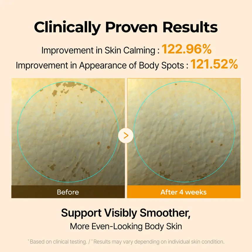 Dr.Melaxin – Kojic Acid Turmeric Capsule Body Cream – Crème corps éclaircissante 200g