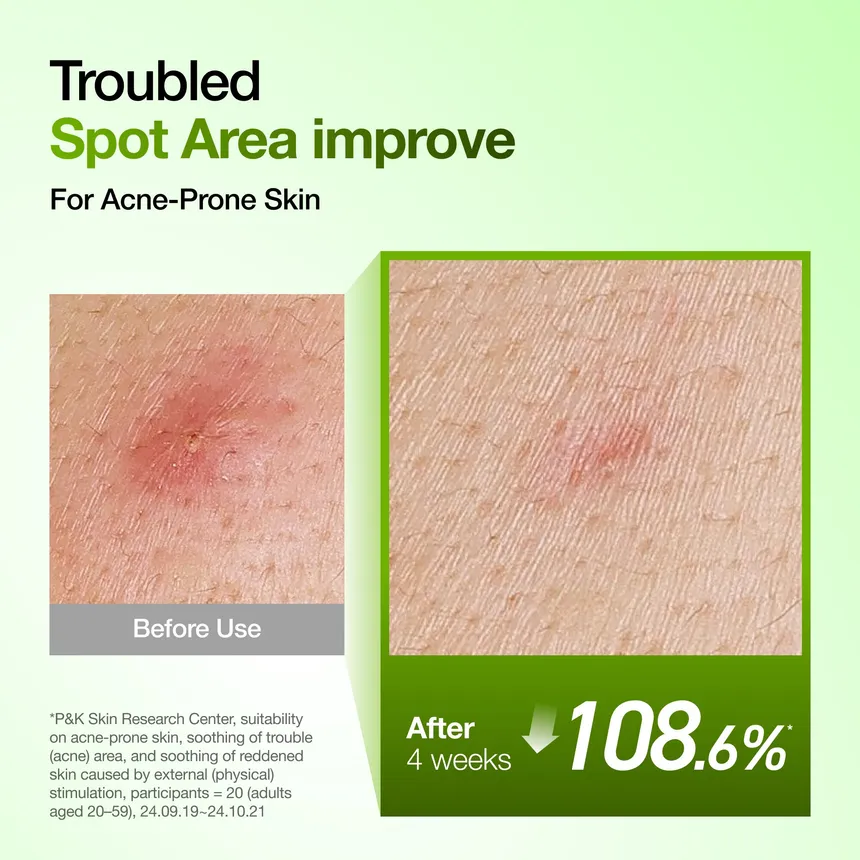 Anua – Kpop Demon Hunters Azelaic Acid 10 Hyaluron Redness Soothing Serum Set 50ml
