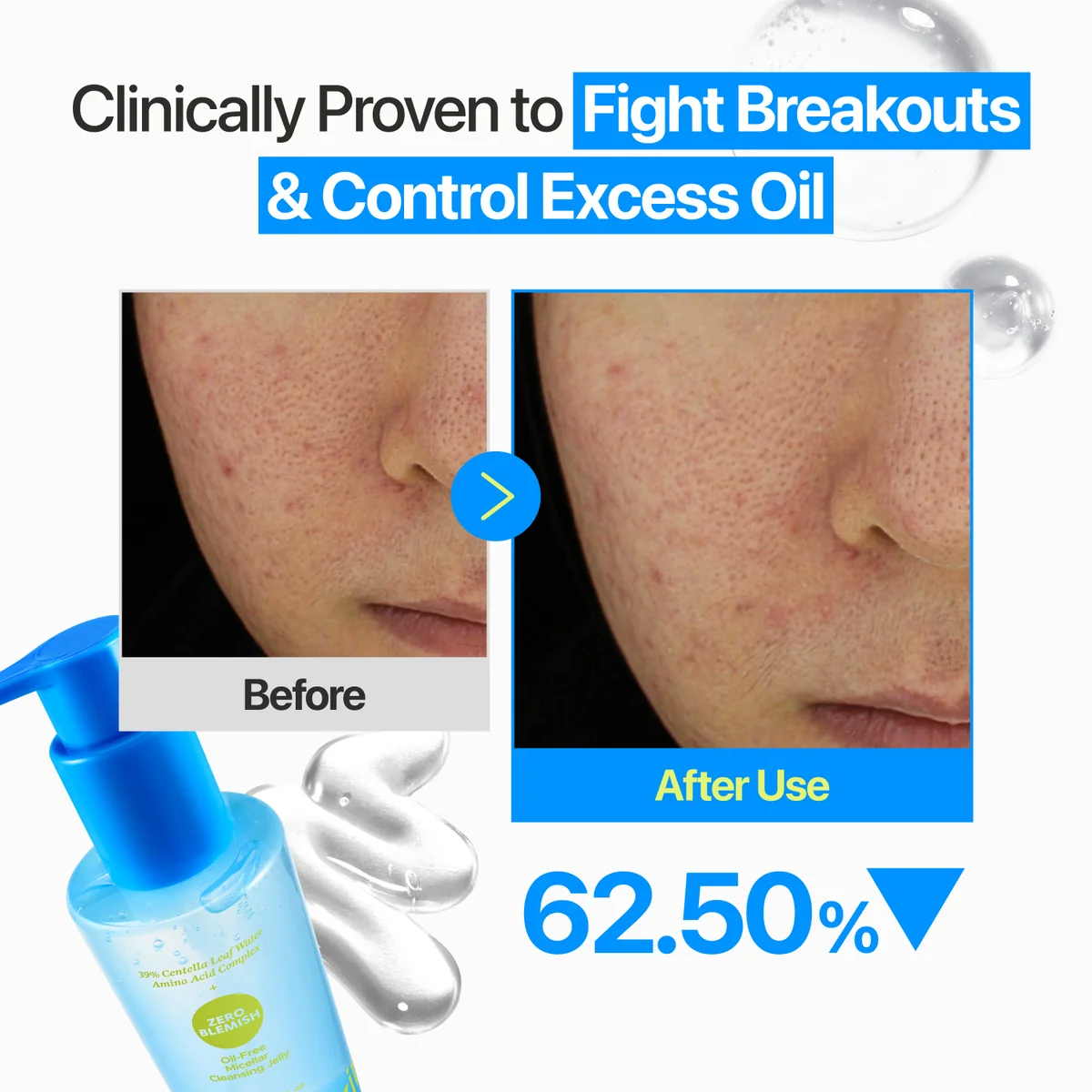 numbuzin Zero Blemish Oil-Free Micellar Cleansing Jelly 6.76 fl oz