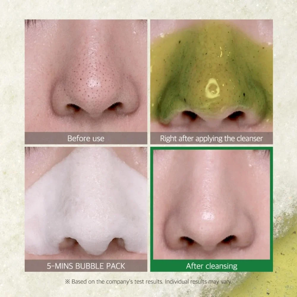 منظف فقاعات الرؤوس السوداء من سوم باي مي 120 مل – Some by Me Bubble Cleanser 120 ml