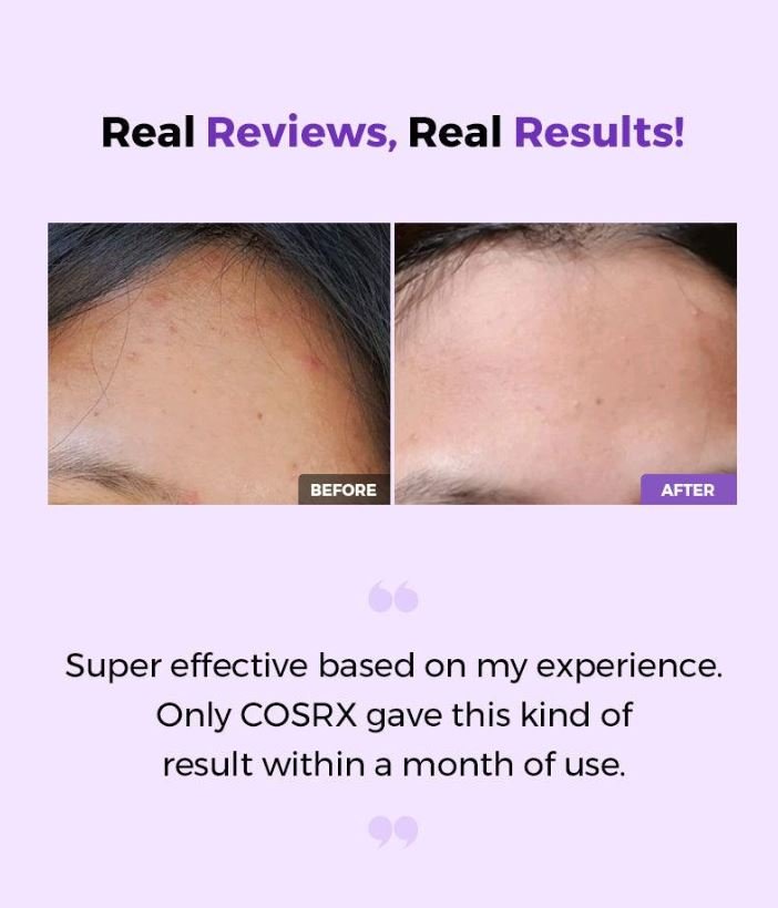 COSRX AHA/BHA Clarifying Treatment Toner تونر بخاخ منقي بحمض ألفا هيدروكسي 150ml
