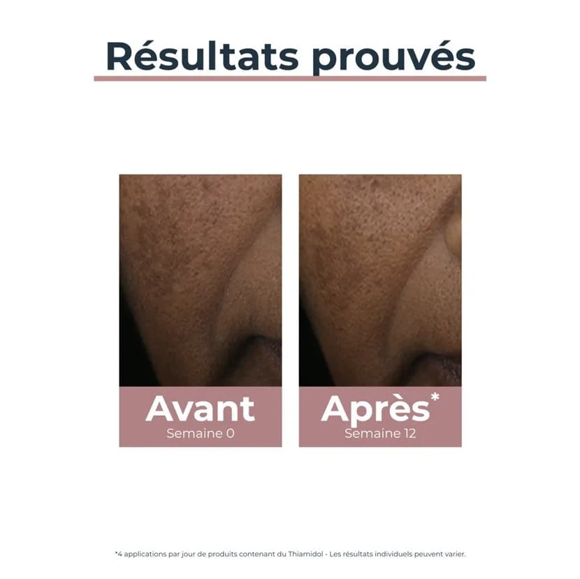 EUCERIN ANTI-PIGMENT Correcteur de taches 5ML