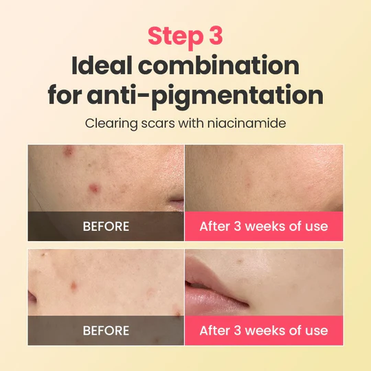 Dr.G R.E.D Blemish Repair Soothing Cream Holiday Special 50ml vitamin c