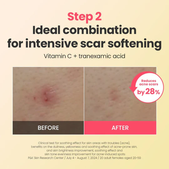 Dr.G R.E.D Blemish Repair Soothing Cream Holiday Special 50ml vitamin c