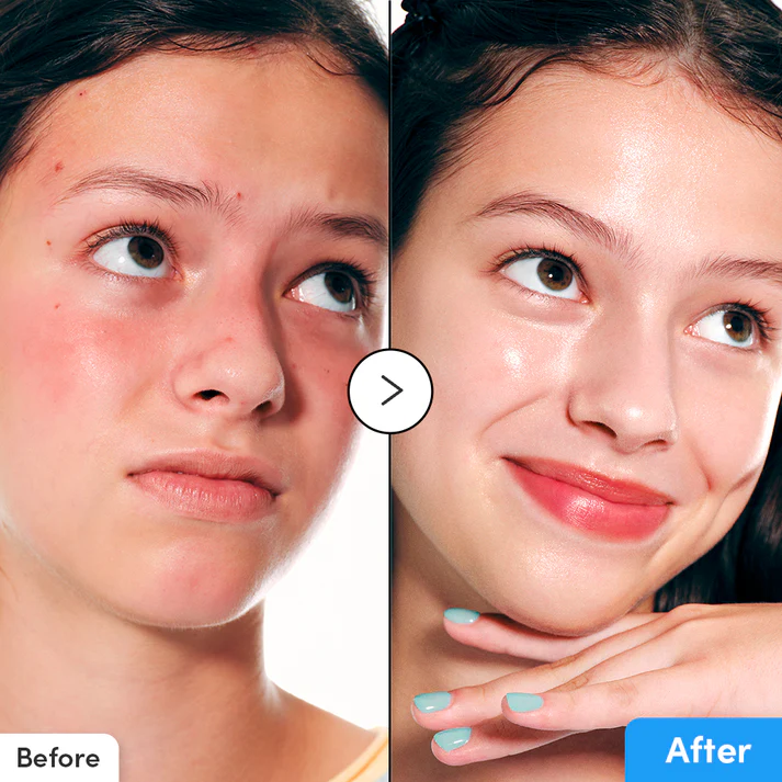 EQQUQLBERRY Hyaltoin Flooding Serum
