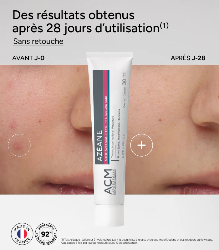 ACM Azéane Crème 15% Acide Azélaïque 30g